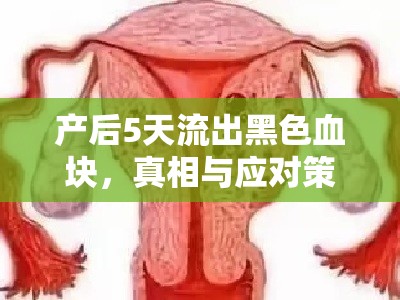 產(chǎn)后5天流出黑色血塊，真相與應(yīng)對策略