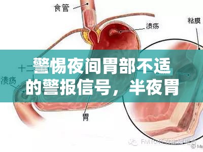 警惕夜間胃部不適的警報(bào)信號(hào)，半夜胃出血的緊急提示