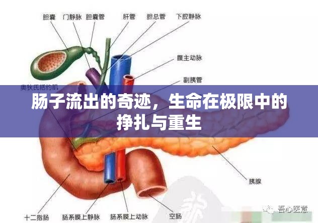 腸子流出的奇跡，生命在極限中的掙扎與重生