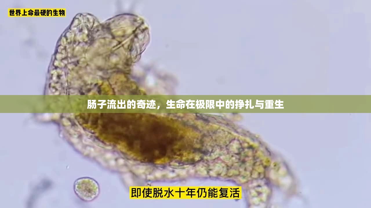 腸子流出的奇跡，生命在極限中的掙扎與重生