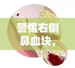 警惕右側(cè)鼻血塊，潛在健康信號與應(yīng)對策略