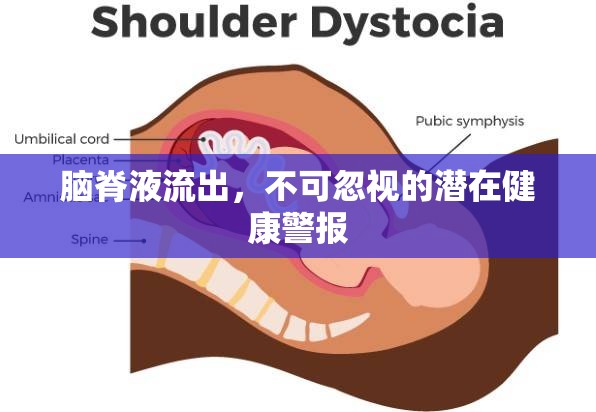 腦脊液流出，不可忽視的潛在健康警報(bào)