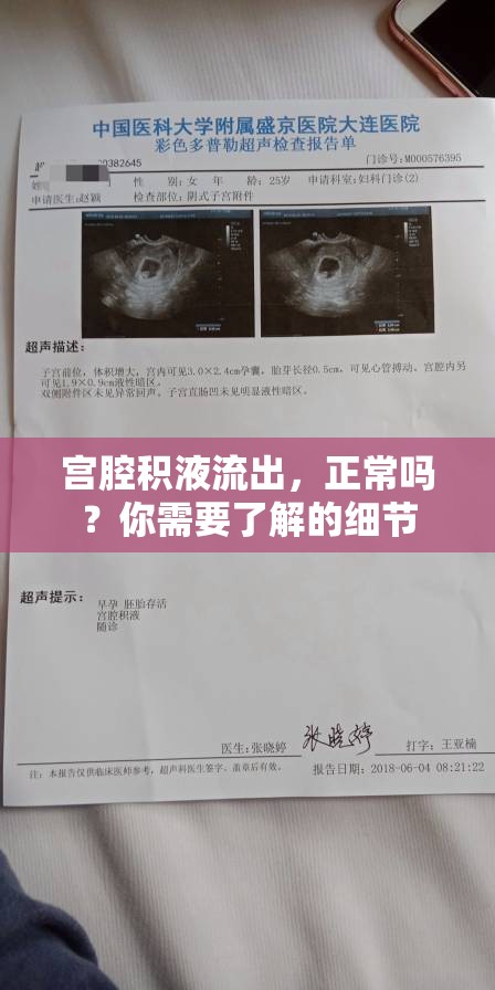 宮腔積液流出，正常嗎？你需要了解的細(xì)節(jié)