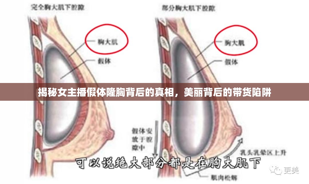 揭秘女主播假體隆胸背后的真相，美麗背后的帶貨陷阱