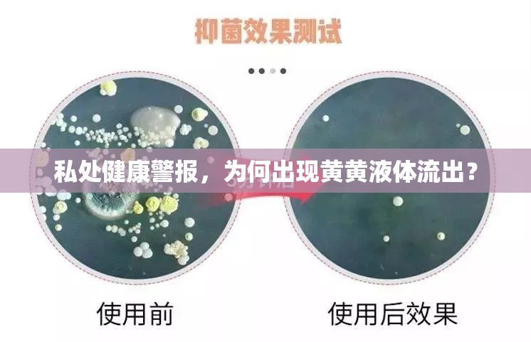 私處健康警報，為何出現(xiàn)黃黃液體流出？