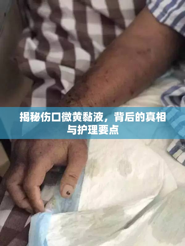 揭秘傷口微黃黏液，背后的真相與護(hù)理要點(diǎn)