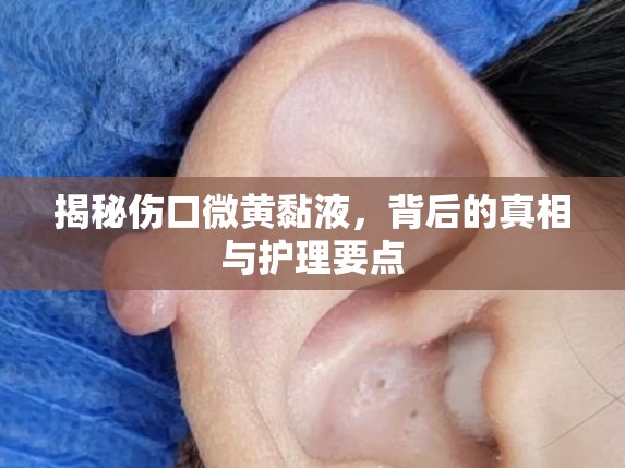 揭秘傷口微黃黏液，背后的真相與護(hù)理要點(diǎn)