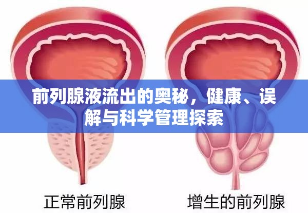 前列腺液流出的奧秘，健康、誤解與科學管理探索