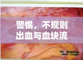 警惕，不規(guī)則出血與血塊流出的健康風(fēng)險(xiǎn)