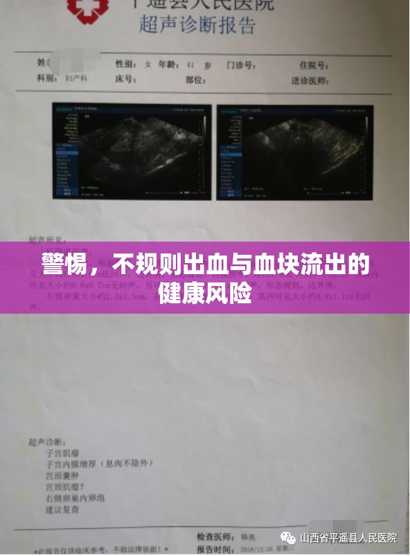 警惕，不規(guī)則出血與血塊流出的健康風(fēng)險(xiǎn)