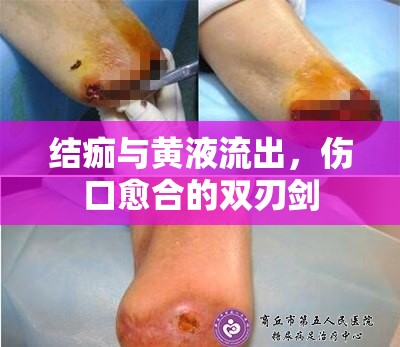 結(jié)痂與黃液流出，傷口愈合的雙刃劍