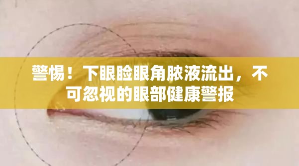 警惕！下眼瞼眼角膿液流出，不可忽視的眼部健康警報(bào)
