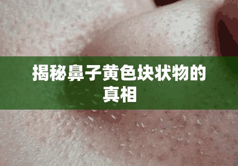 揭秘鼻子黃色塊狀物的真相