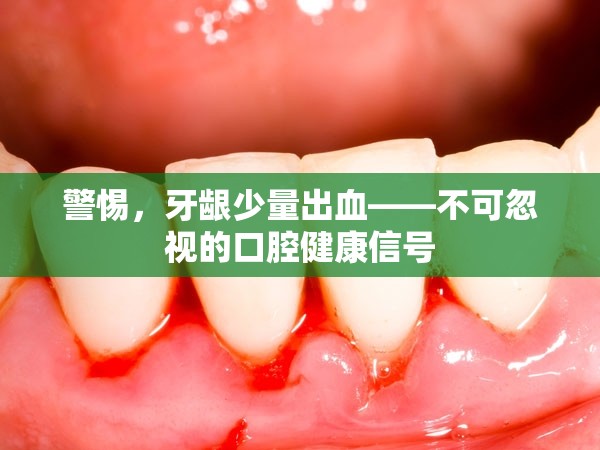警惕，牙齦少量出血——不可忽視的口腔健康信號(hào)