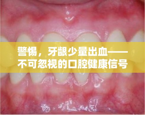 警惕，牙齦少量出血——不可忽視的口腔健康信號(hào)