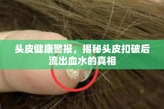 頭皮健康警報，揭秘頭皮扣破后流出血水的真相