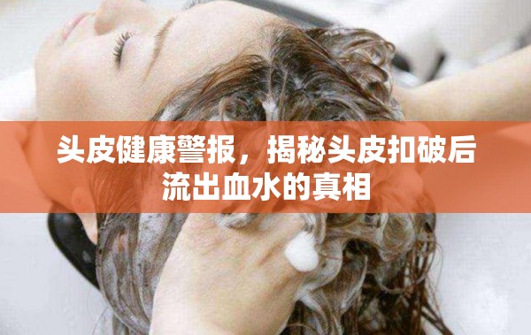 頭皮健康警報，揭秘頭皮扣破后流出血水的真相