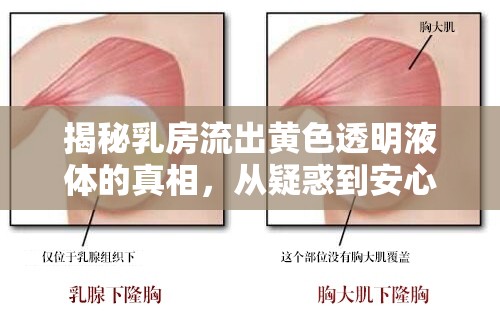 揭秘乳房流出黃色透明液體的真相，從疑惑到安心