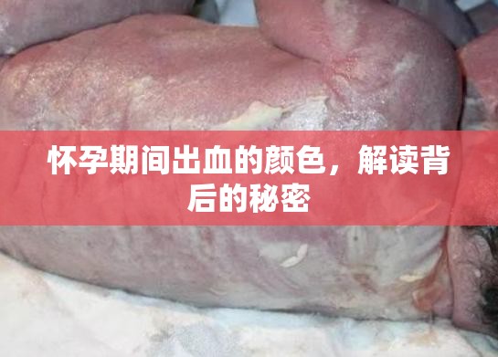 懷孕期間出血的顏色，解讀背后的秘密