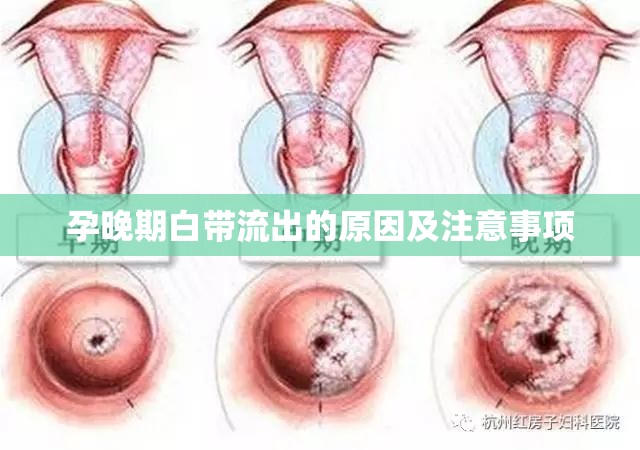 孕晚期白帶流出的原因及注意事項(xiàng)
