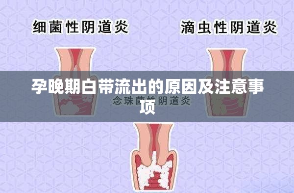 孕晚期白帶流出的原因及注意事項(xiàng)