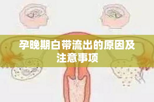 孕晚期白帶流出的原因及注意事項(xiàng)