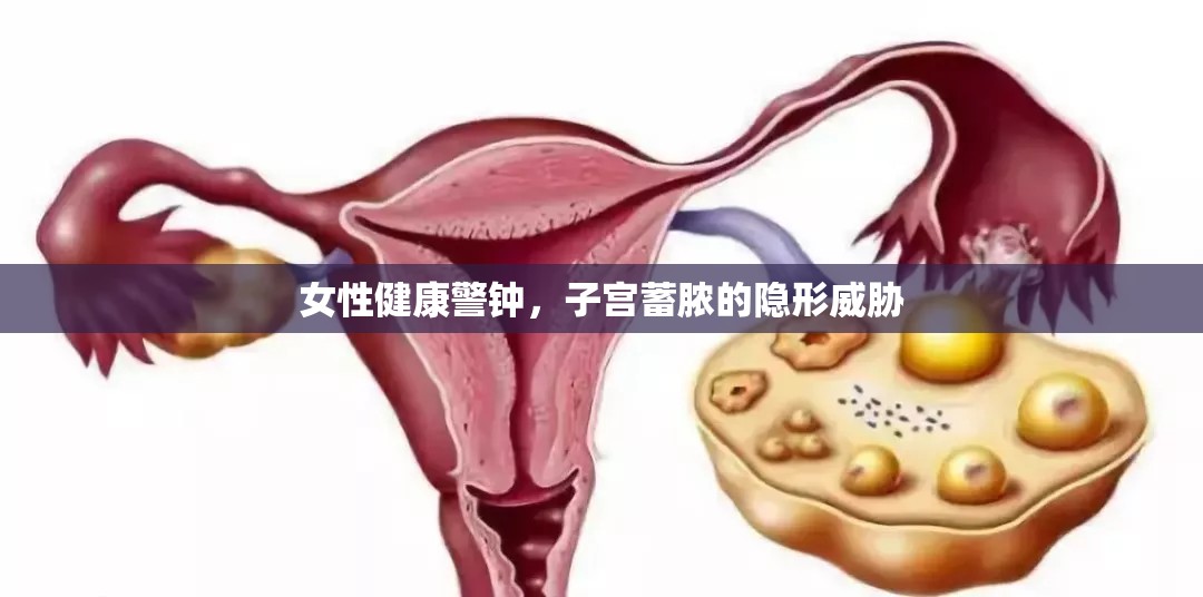 女性健康警鐘，子宮蓄膿的隱形威脅