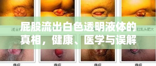 屁股流出白色透明液體的真相，健康、醫(yī)學(xué)與誤解的交織