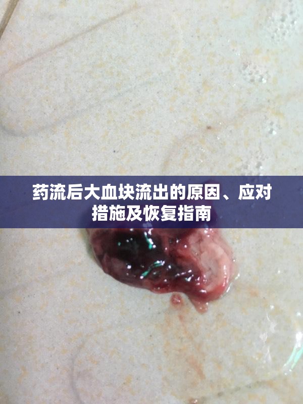 藥流后大血塊流出的原因、應(yīng)對措施及恢復(fù)指南