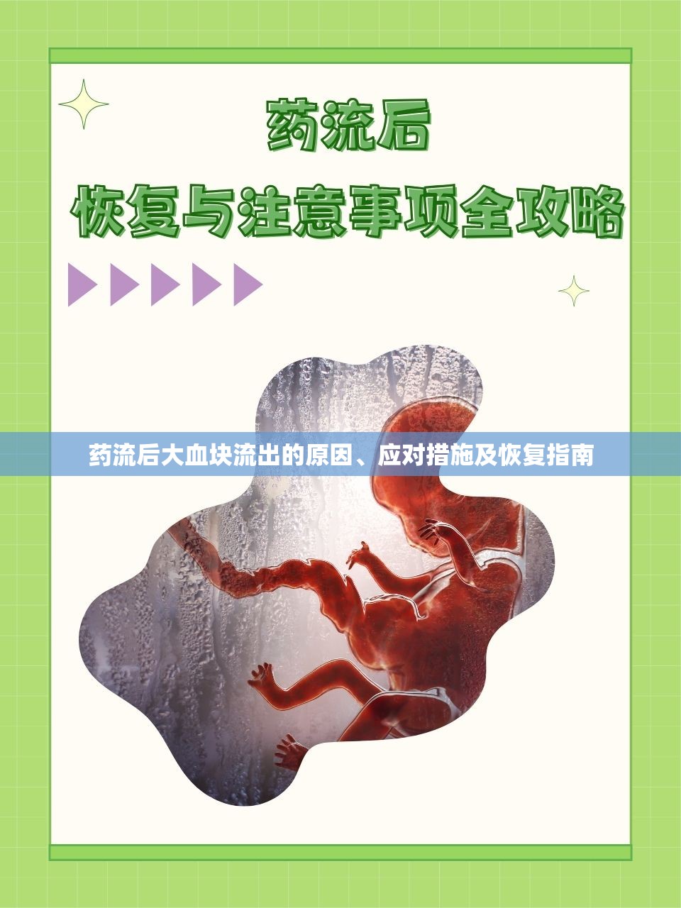 藥流后大血塊流出的原因、應(yīng)對措施及恢復(fù)指南