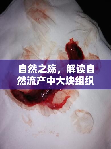 自然之殤，解讀自然流產(chǎn)中大塊組織流出的現(xiàn)象與應(yīng)對(duì)策略