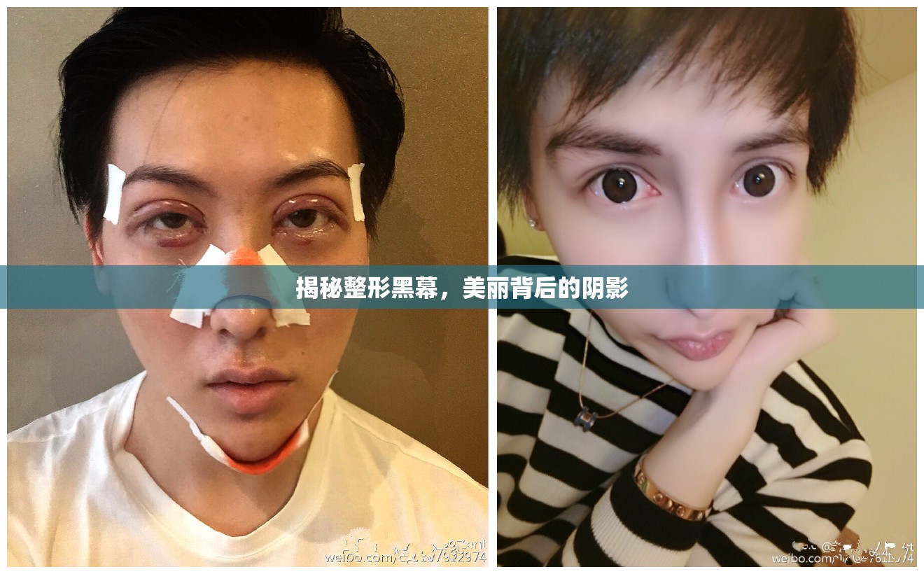 揭秘整形黑幕，美麗背后的陰影