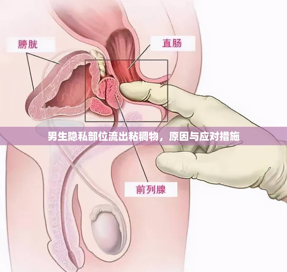男生隱私部位流出粘稠物，原因與應(yīng)對(duì)措施
