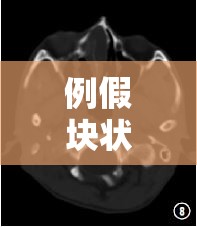 例假塊狀流出，生理現(xiàn)象解析與健康關(guān)懷指南