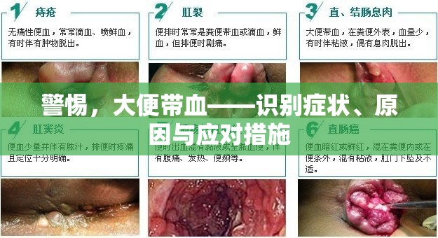 警惕，大便帶血——識(shí)別癥狀、原因與應(yīng)對(duì)措施
