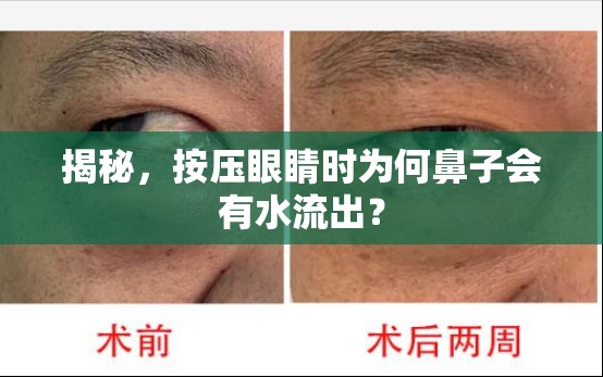 揭秘，按壓眼睛時(shí)為何鼻子會(huì)有水流出？