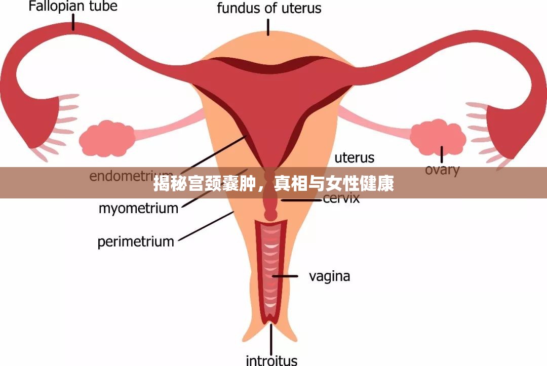 揭秘宮頸囊腫，真相與女性健康