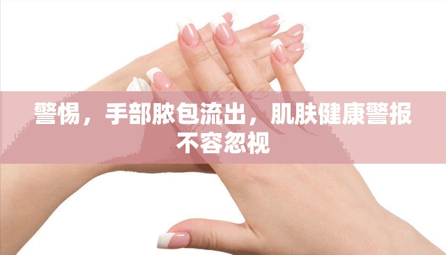 警惕，手部膿包流出，肌膚健康警報(bào)不容忽視