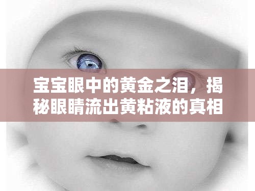 寶寶眼中的黃金之淚，揭秘眼睛流出黃粘液的真相