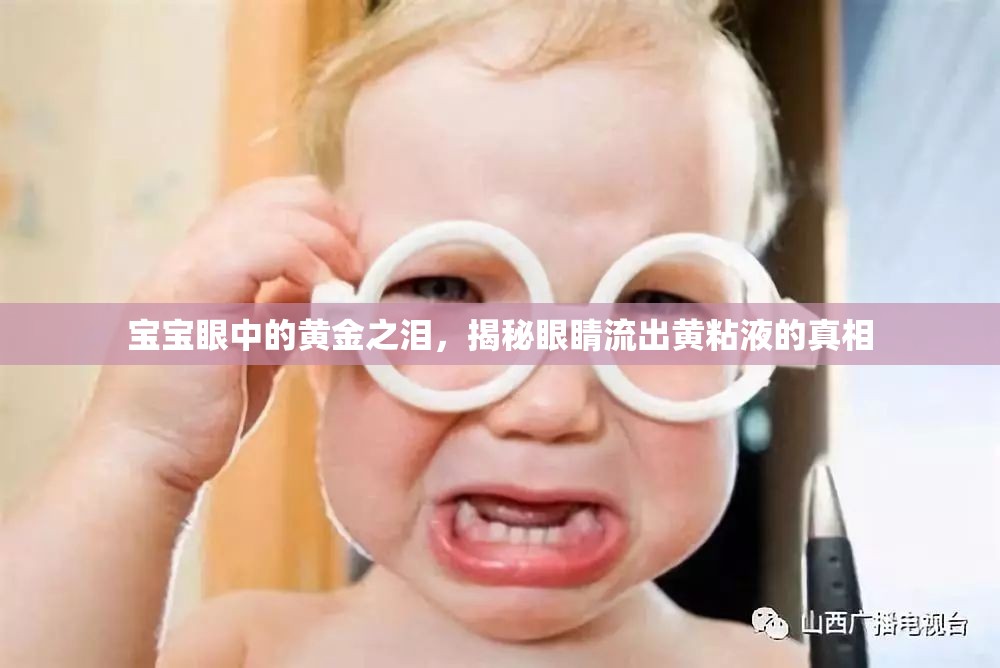 寶寶眼中的黃金之淚，揭秘眼睛流出黃粘液的真相