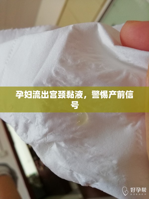 孕婦流出宮頸黏液，警惕產(chǎn)前信號(hào)