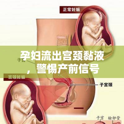 孕婦流出宮頸黏液，警惕產(chǎn)前信號(hào)