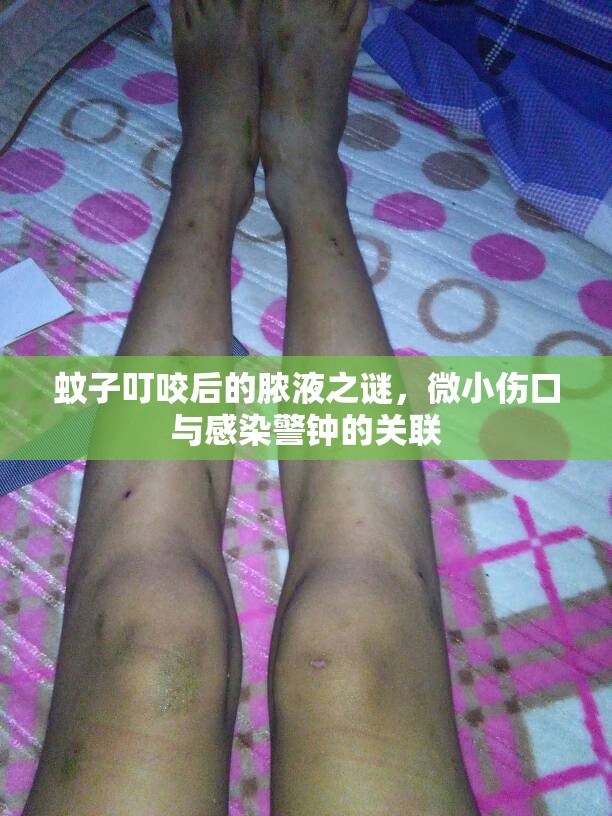 蚊子叮咬后的膿液之謎，微小傷口與感染警鐘的關(guān)聯(lián)