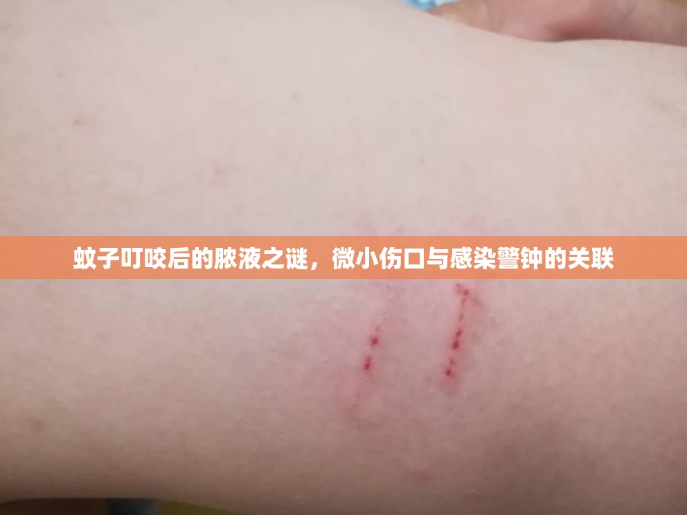 蚊子叮咬后的膿液之謎，微小傷口與感染警鐘的關(guān)聯(lián)