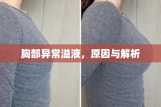 胸部異常溢液，原因與解析