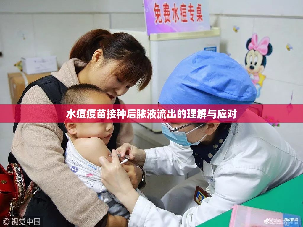 水痘疫苗接種后膿液流出的理解與應(yīng)對(duì)