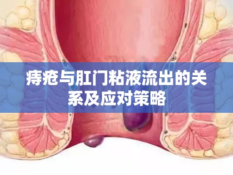 痔瘡與肛門粘液流出的關(guān)系及應(yīng)對策略