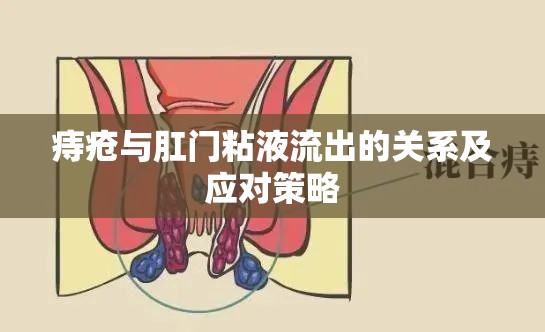 痔瘡與肛門粘液流出的關(guān)系及應(yīng)對策略