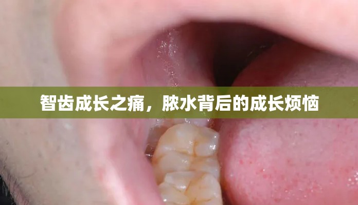 智齒成長之痛，膿水背后的成長煩惱