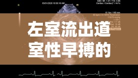 左室流出道室性早搏的心路徑探索、治療策略及最新進展